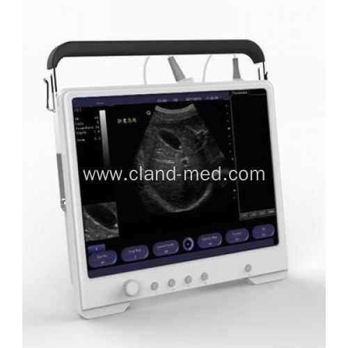 Portable Ultrasound Scanner Digital Ultrasound Machine Price